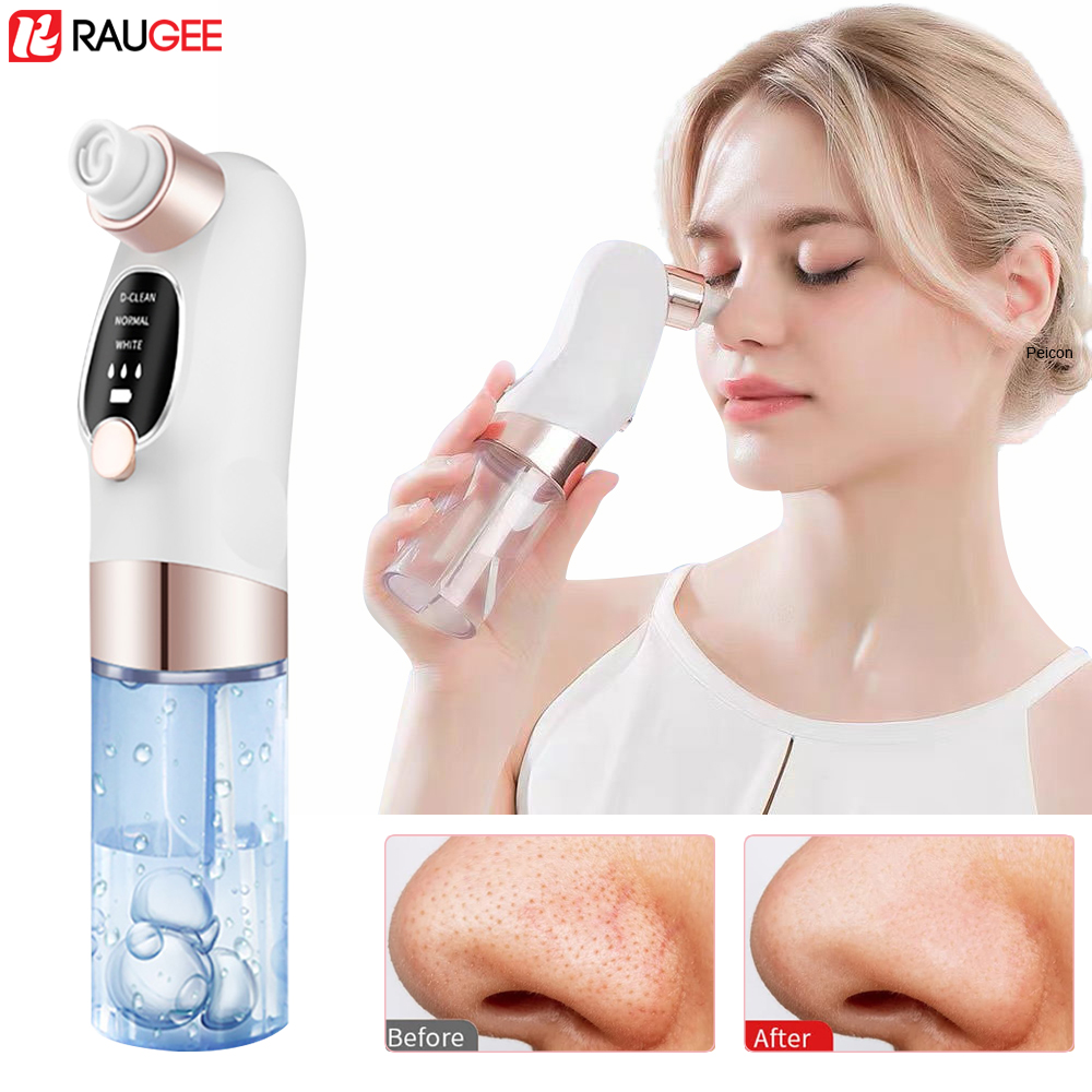 Blackhead Remover Electric Bla - Air Bubble Remover recensie en prijs