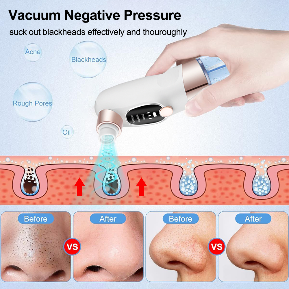 Blackhead Remover Electric Bla - Air Bubble Remover recensie en prijs